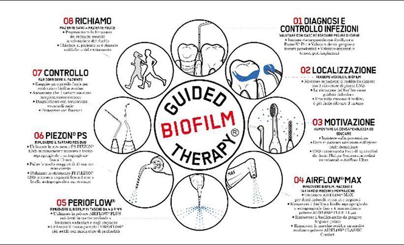 Protocollo Guided Biofilm Therapy